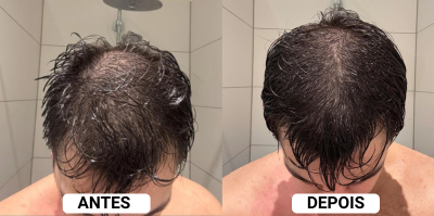 Depoimento 1