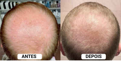 Depoimento 3