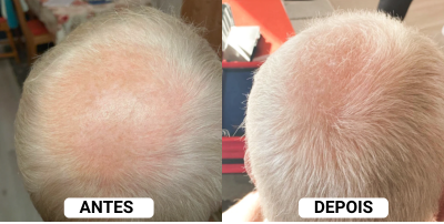 Depoimento 5