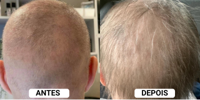 Depoimento 6